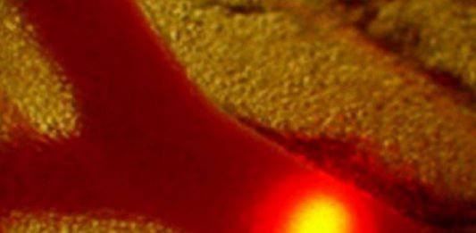 Novo Laser destrói células cancerígenas e bloqueia metástases