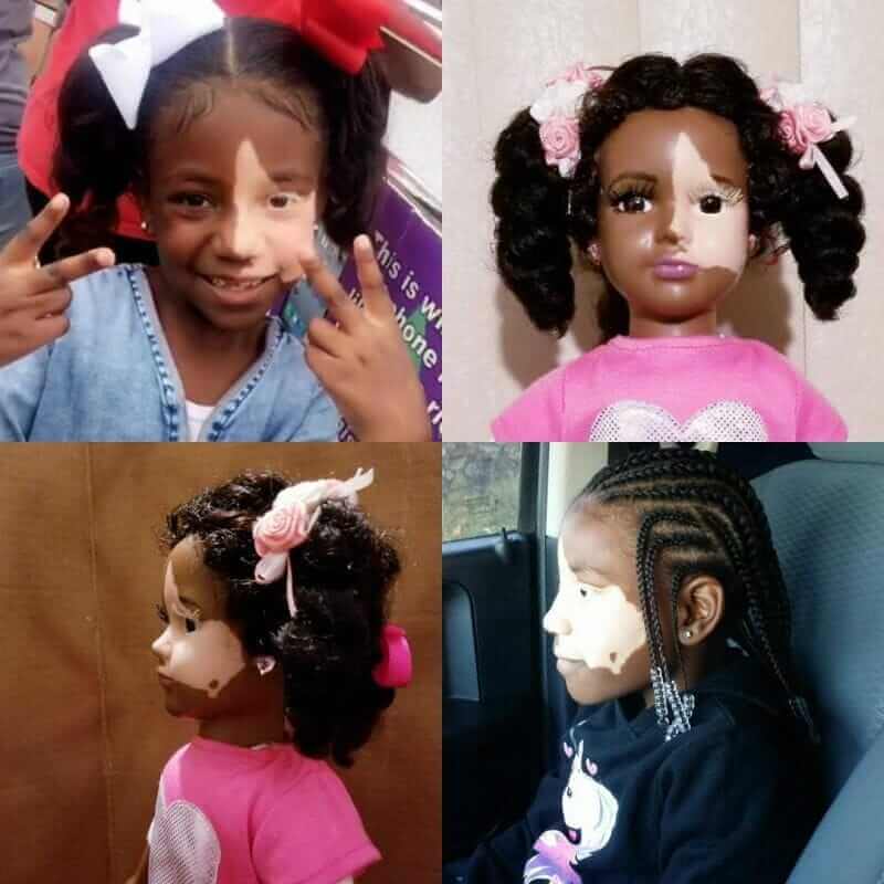 bonecas com vitiligo ajudam criancas com mesma condicao a gostarem de si mesmas10 - Artista cria uma linha de bonecas com vitiligo e ajuda crianças a se amarem do jeito que são