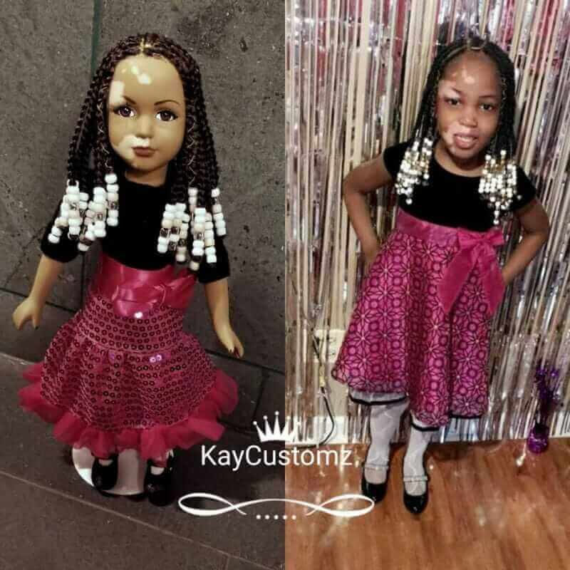 bonecas com vitiligo ajudam criancas com mesma condicao a gostarem de si mesmas13 - Artista cria uma linha de bonecas com vitiligo e ajuda crianças a se amarem do jeito que são