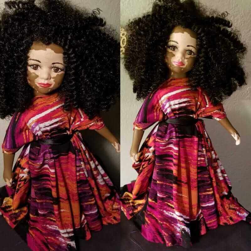 sensivel-mente.com - Artista cria uma linha de bonecas com vitiligo e ajuda crianças a se amarem do jeito que são