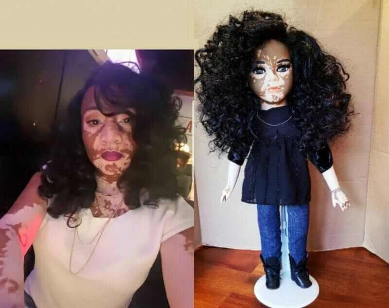 bonecas com vitiligo ajudam criancas com mesma condicao a gostarem de si mesmas3 - Artista cria uma linha de bonecas com vitiligo e ajuda crianças a se amarem do jeito que são