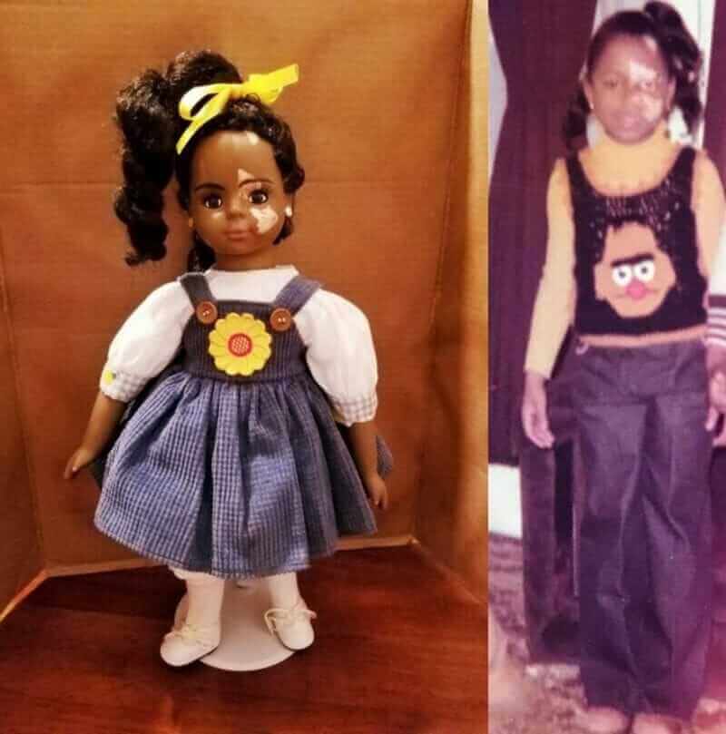 sensivel-mente.com - Artista cria uma linha de bonecas com vitiligo e ajuda crianças a se amarem do jeito que são