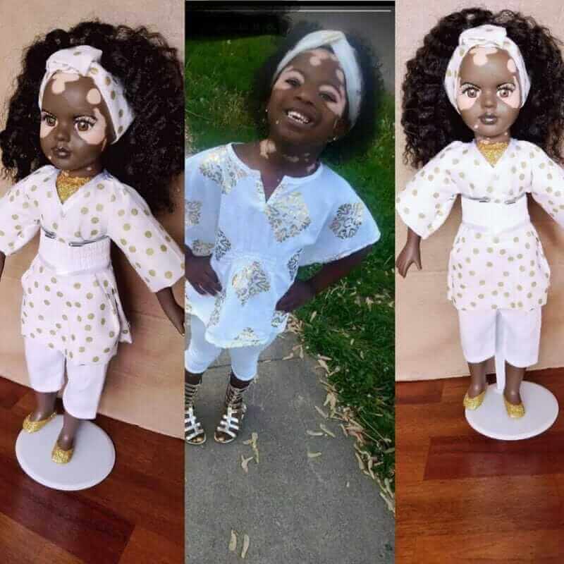 bonecas com vitiligo ajudam criancas com mesma condicao a gostarem de si mesmas8 - Artista cria uma linha de bonecas com vitiligo e ajuda crianças a se amarem do jeito que são