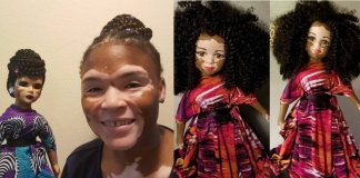 Artista cria uma linha de bonecas com vitiligo e ajuda crianças a se amarem do jeito que são