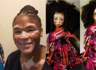 Artista cria uma linha de bonecas com vitiligo e ajuda crianças a se amarem do jeito que são