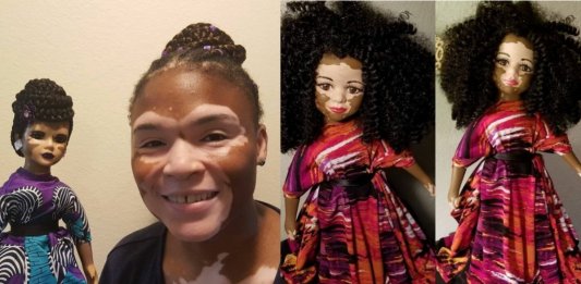 Artista cria uma linha de bonecas com vitiligo e ajuda crianças a se amarem do jeito que são