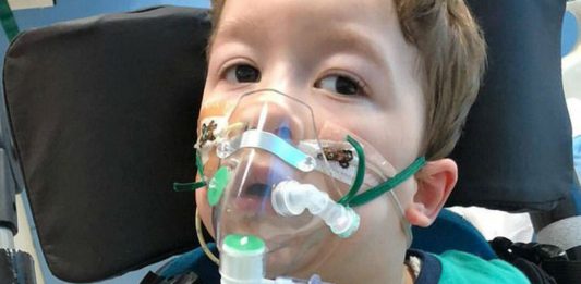 Garotinho que viveria para sempre na cadeira de rodas consegue andar pela 1ª vez! Veja.