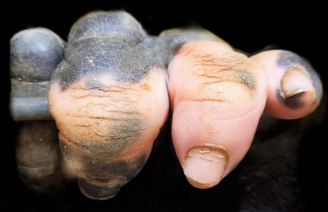 Um gorila nascido com falta de pigmentação nos dedos surpreende as pessoas com um detalhe curioso