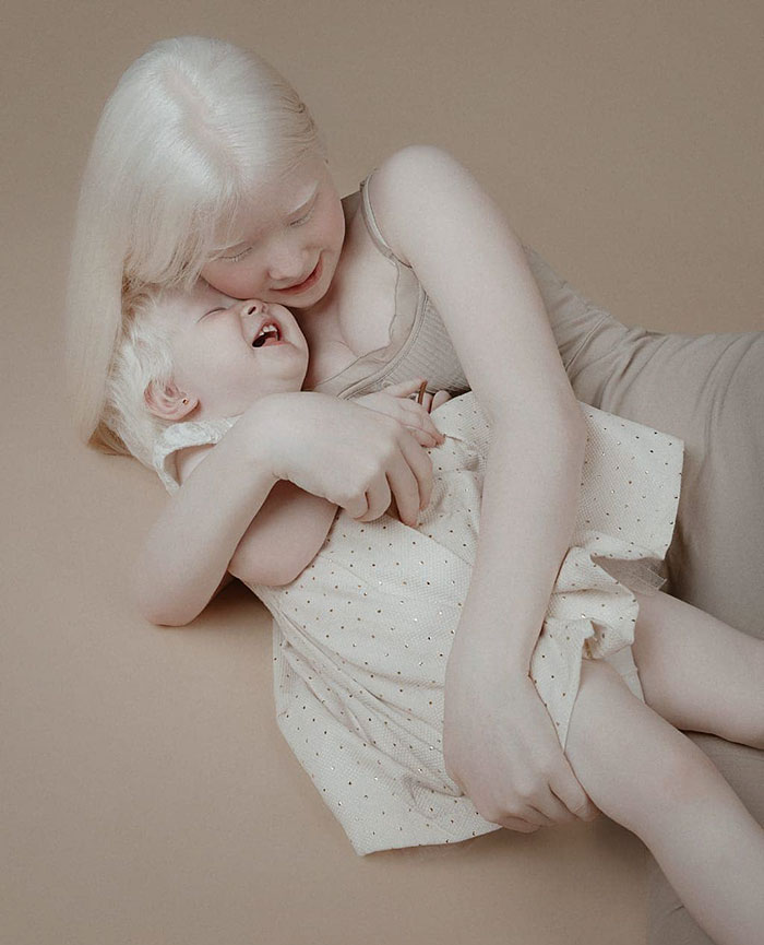 1 7 - Irmãs albinas surpreendem o mundo com sua beleza extraordinária