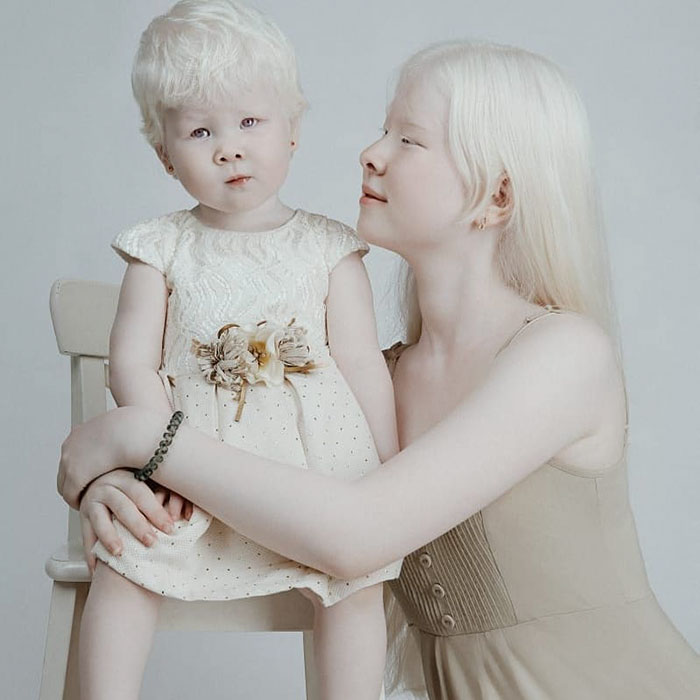 11 1 - Irmãs albinas surpreendem o mundo com sua beleza extraordinária
