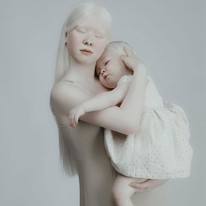 12 1 - Irmãs albinas surpreendem o mundo com sua beleza extraordinária