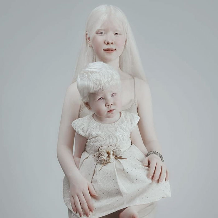 14 1 - Irmãs albinas surpreendem o mundo com sua beleza extraordinária
