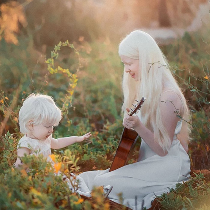 15 1 - Irmãs albinas surpreendem o mundo com sua beleza extraordinária