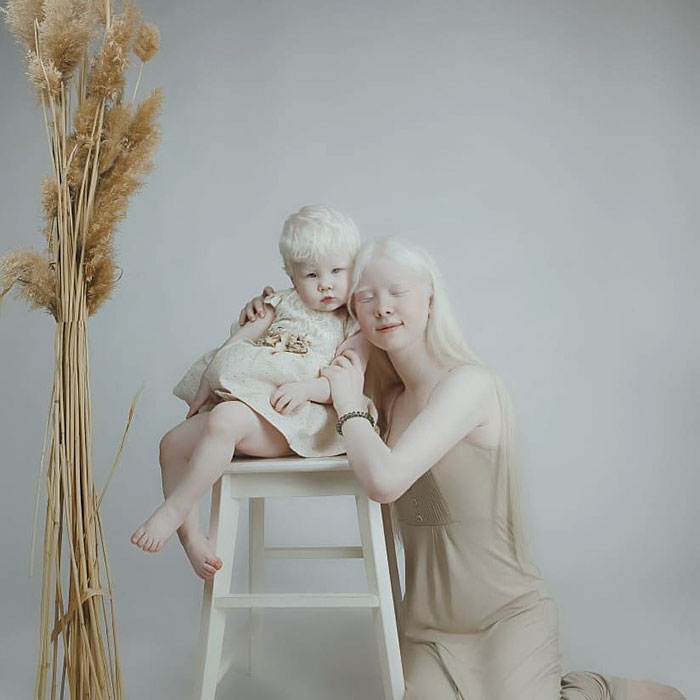 16 1 - Irmãs albinas surpreendem o mundo com sua beleza extraordinária