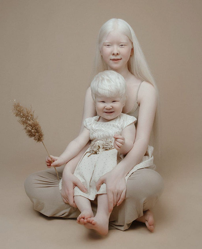 17 - Irmãs albinas surpreendem o mundo com sua beleza extraordinária