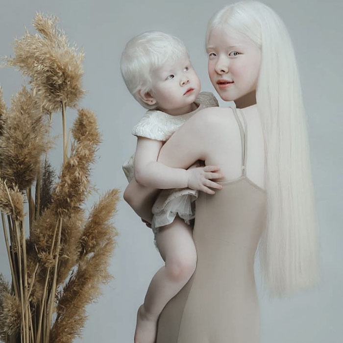 2 10 - Irmãs albinas surpreendem o mundo com sua beleza extraordinária