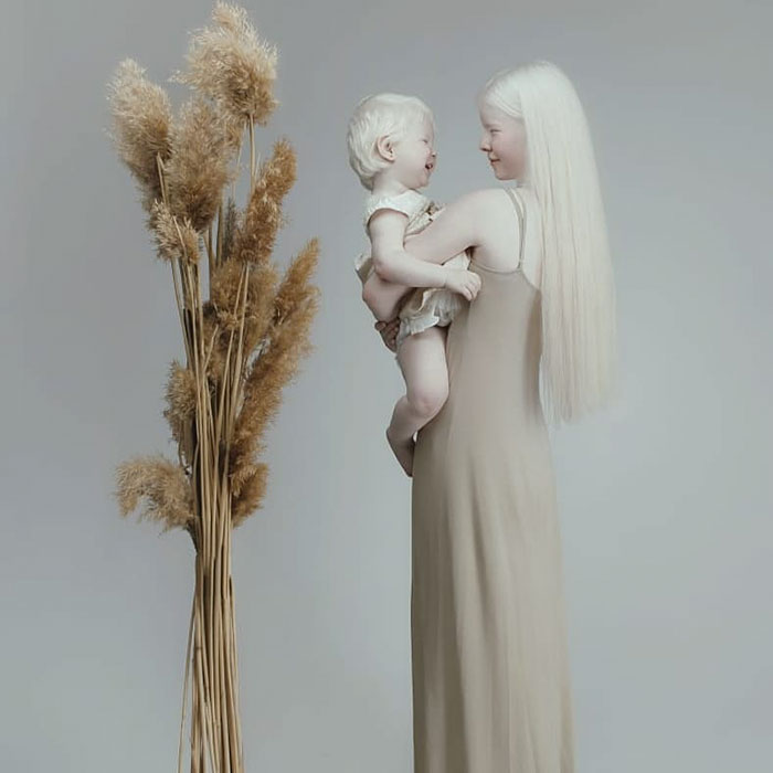 20 - Irmãs albinas surpreendem o mundo com sua beleza extraordinária