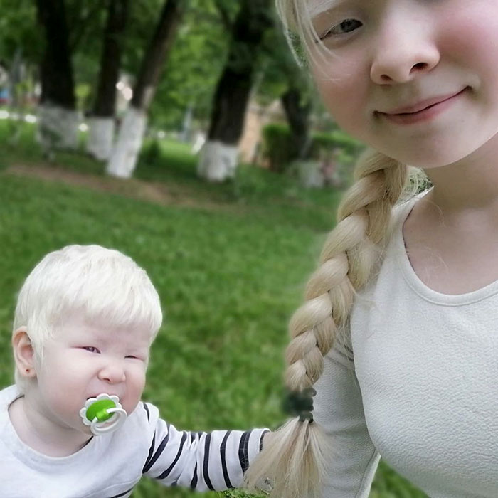 21 - Irmãs albinas surpreendem o mundo com sua beleza extraordinária