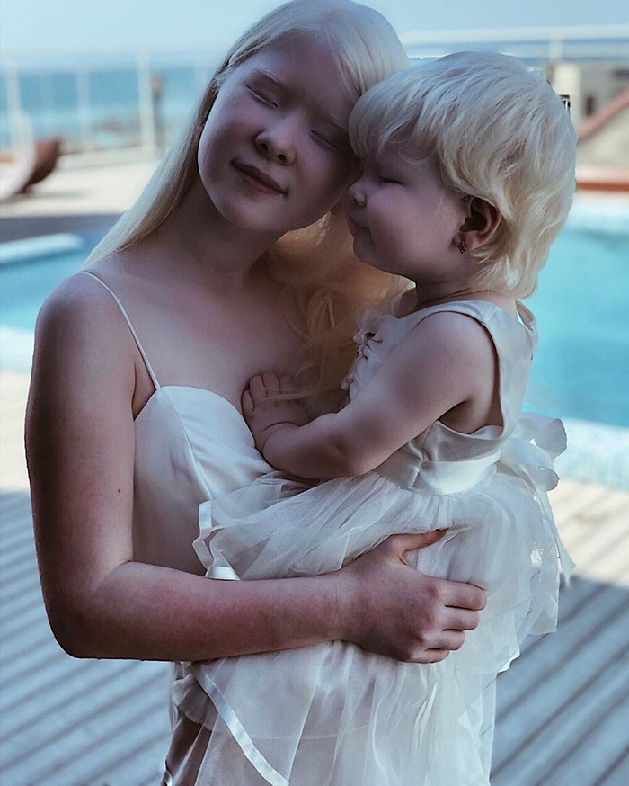 22 - Irmãs albinas surpreendem o mundo com sua beleza extraordinária