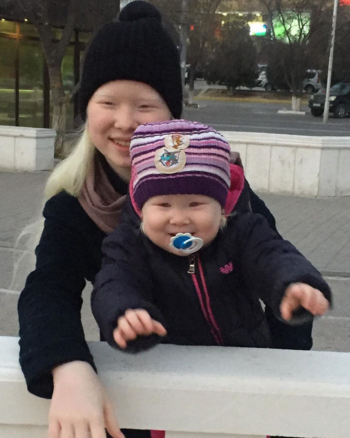 23 - Irmãs albinas surpreendem o mundo com sua beleza extraordinária