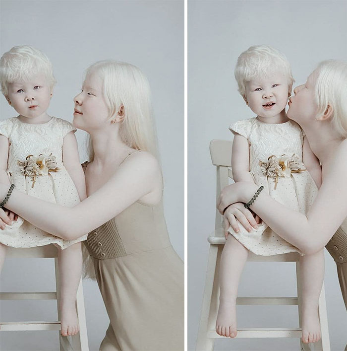 3 9 - Irmãs albinas surpreendem o mundo com sua beleza extraordinária