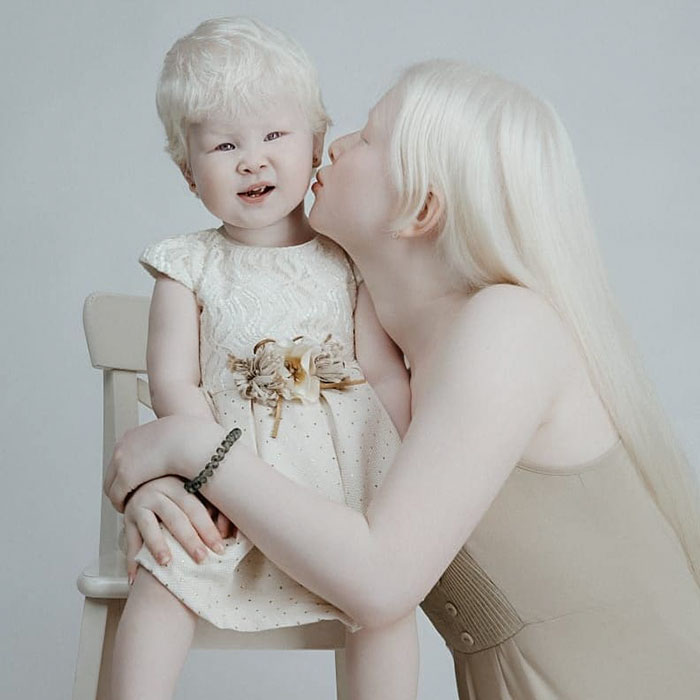 4 8 - Irmãs albinas surpreendem o mundo com sua beleza extraordinária