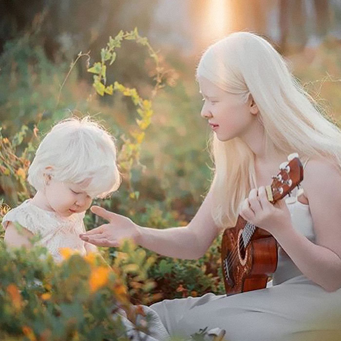 5 6 - Irmãs albinas surpreendem o mundo com sua beleza extraordinária