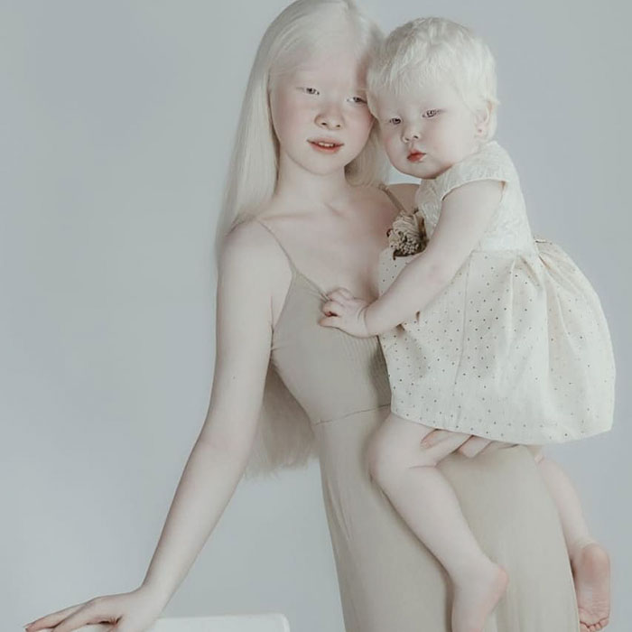 7 - Irmãs albinas surpreendem o mundo com sua beleza extraordinária