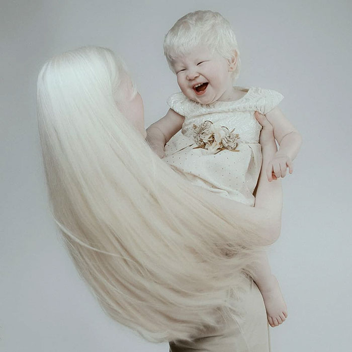 8 1 - Irmãs albinas surpreendem o mundo com sua beleza extraordinária