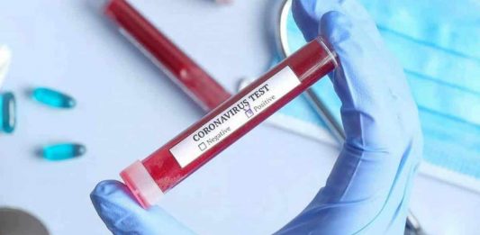 Planos de saúde serão obrigados a cobrir testes sorológicos da Covid-19 a partir de hoje