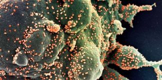 Foto ampliada do coronavírus em uma célula foi a “imagem do dia” feita pela NASA.