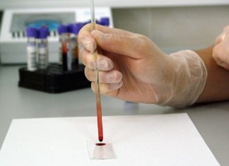 Novo exame de sangue para detectar câncer de próstata com precisão de 99%