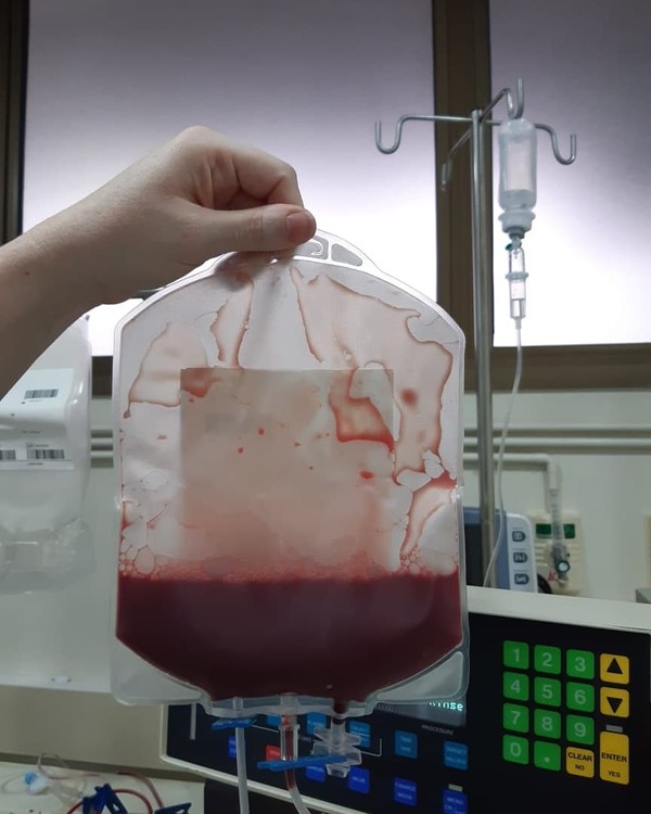 Jovem doa medula óssea duas vezes para a mesma pessoa em 3 meses whatsapp image 2020 09 18 at 12.18.27 - Jovem doa medula óssea duas vezes para a mesma pessoa em 3 meses