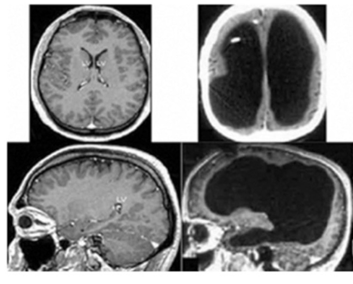 sensivel-mente.com - Uma varredura cerebral revelou que um estudante universitário não tinha cérebro.