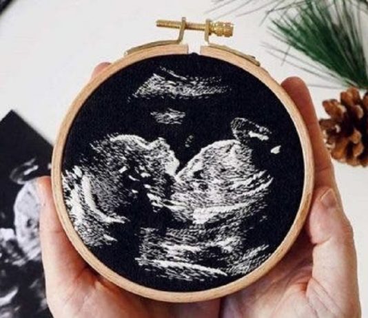 Bordados de Ultrassom fazem sucesso entre os internautas