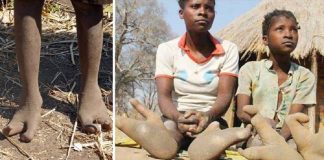 Os pés dos membros dessa tribo africana são como garras de avestruz. Eles só têm dois dedos
