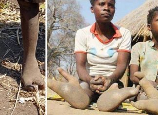 Os pés dos membros dessa tribo africana são como garras de avestruz. Eles só têm dois dedos