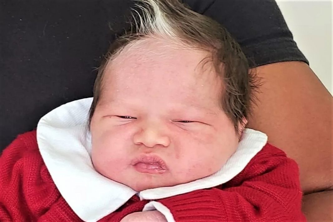 Bebê nasceu com uma mecha de cabelo branca e conquista a simpatia da internet