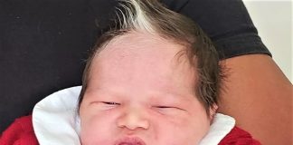 Bebê nasceu com uma mecha de cabelo branca e conquista a simpatia da internet