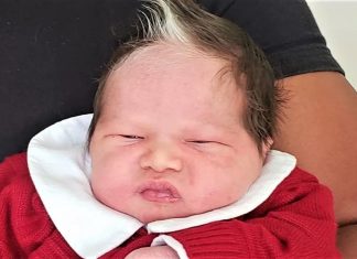 Bebê nasceu com uma mecha de cabelo branca e conquista a simpatia da internet