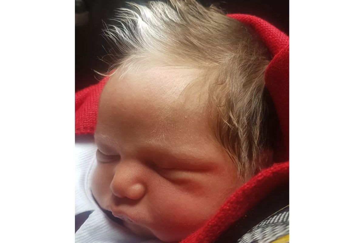 bebe mecha branca 1 - Bebê nasceu com uma mecha de cabelo branca e conquista a simpatia da internet