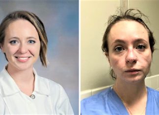 A enfermeira publicou seu “antes e depois” para mostrar o trabalho árduo na pandemia. Isso é o que eles enfrentam