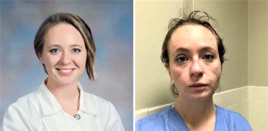 A enfermeira publicou seu “antes e depois” para mostrar o trabalho árduo na pandemia. Isso é o que eles enfrentam