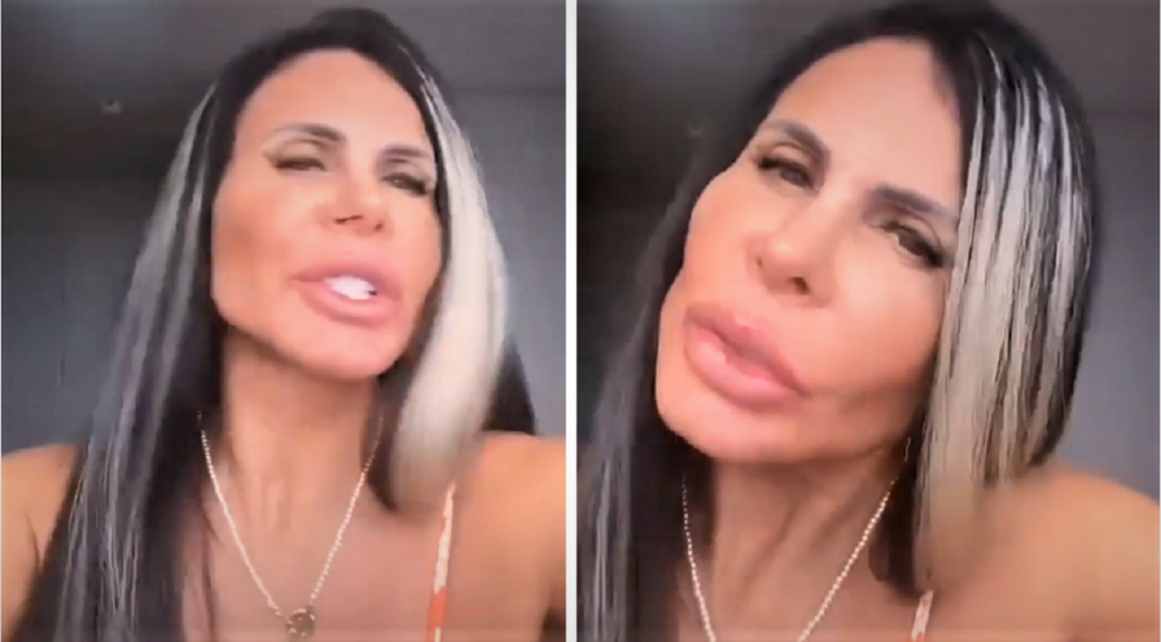 Gretchen ficou irada com as críticas feitas à sua harmonização facial: ”Povinho recalcado”