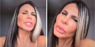 Gretchen ficou irada com as críticas feitas à sua harmonização facial: ”Povinho recalcado”