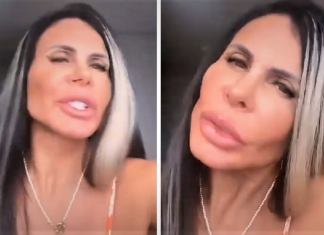 Gretchen ficou irada com as críticas feitas à sua harmonização facial: ”Povinho recalcado”