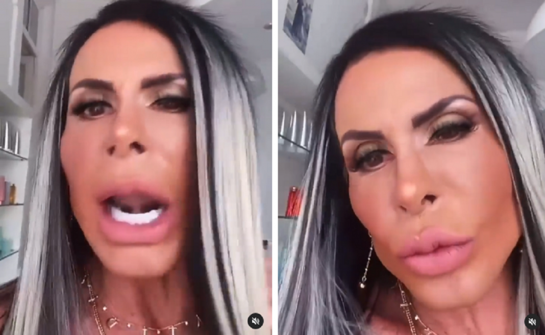 Gretchen mostra o resultado final de seu rosto uma semana após a “harmonização Facial”- (vídeo)