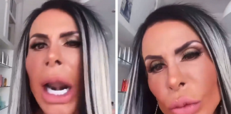 Gretchen mostra o resultado final de seu rosto uma semana após a “harmonização Facial”- (vídeo)