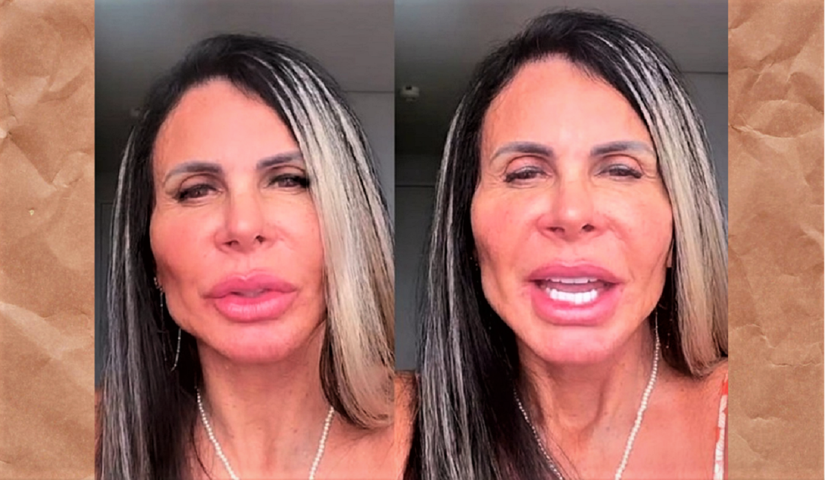 sensivel-mente.com - Gretchen mostra o resultado final de seu rosto uma semana após a “harmonização Facial”- (vídeo)