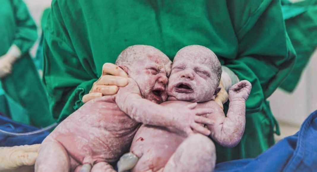 Imagens de gêmeas se abraçando após o parto em SC encanta os internautas